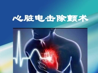 除颤仪心脏除颤术
