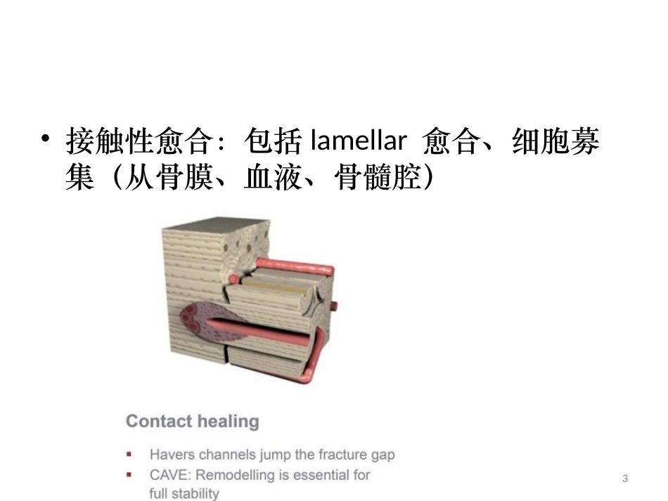 垂直骨增量基础_第3页