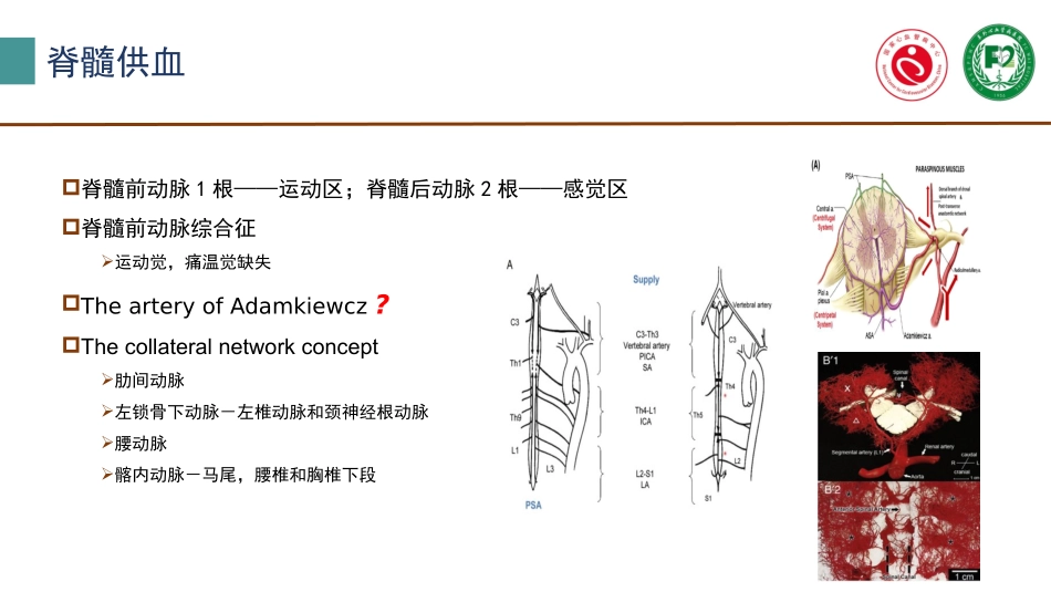 大血管围术期脊髓保护_第3页