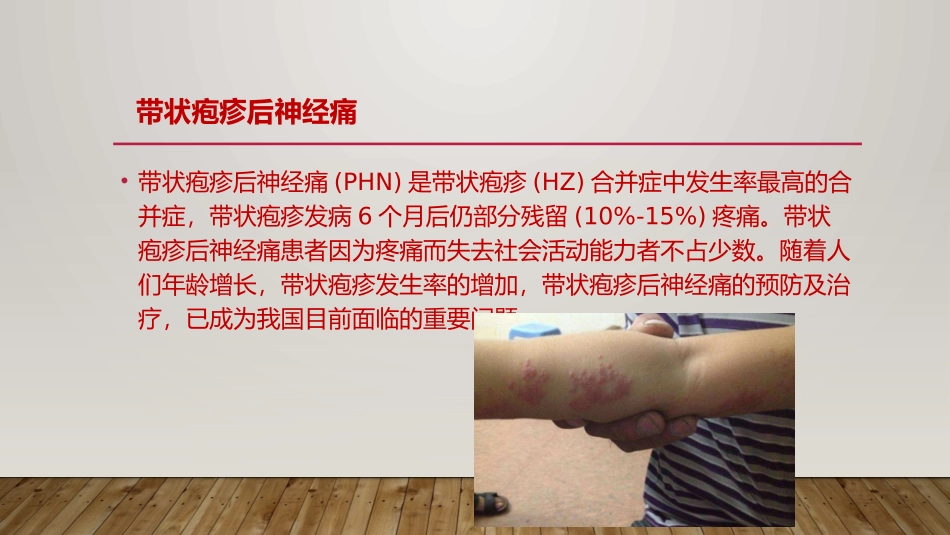 带状疱疹神经痛的诊疗和治疗_第2页