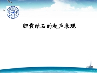 胆囊结石的超声表现