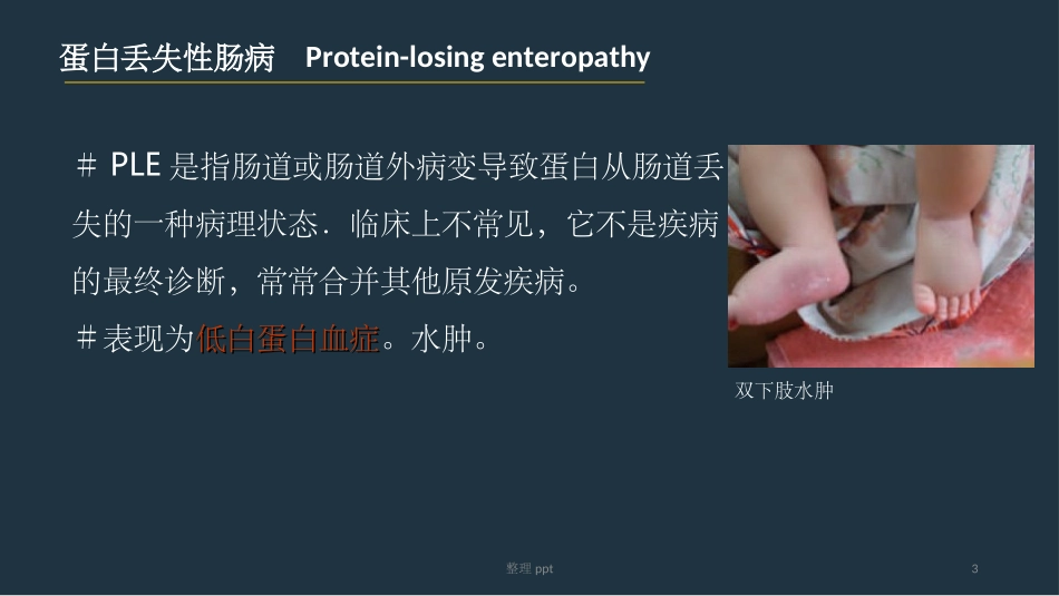蛋白丢失性肠病_第3页
