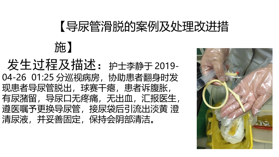 导尿管滑脱的原因及整改措施_第2页