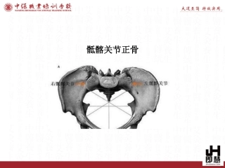 骶髂关节正骨