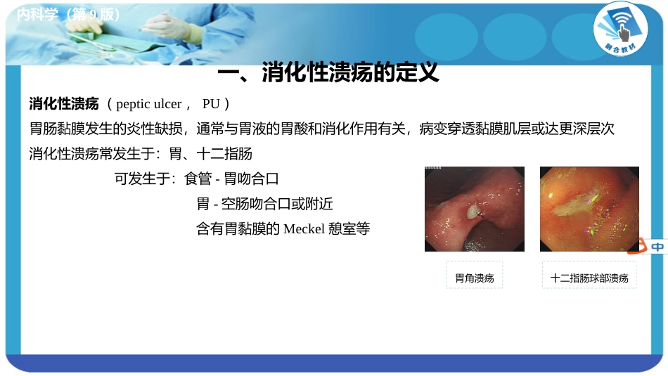 第九版内科学课件消化系统消化性溃疡_第3页