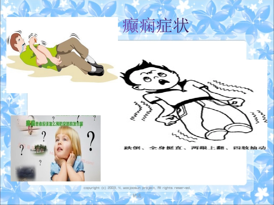 癫痫的健康教育课件_第2页