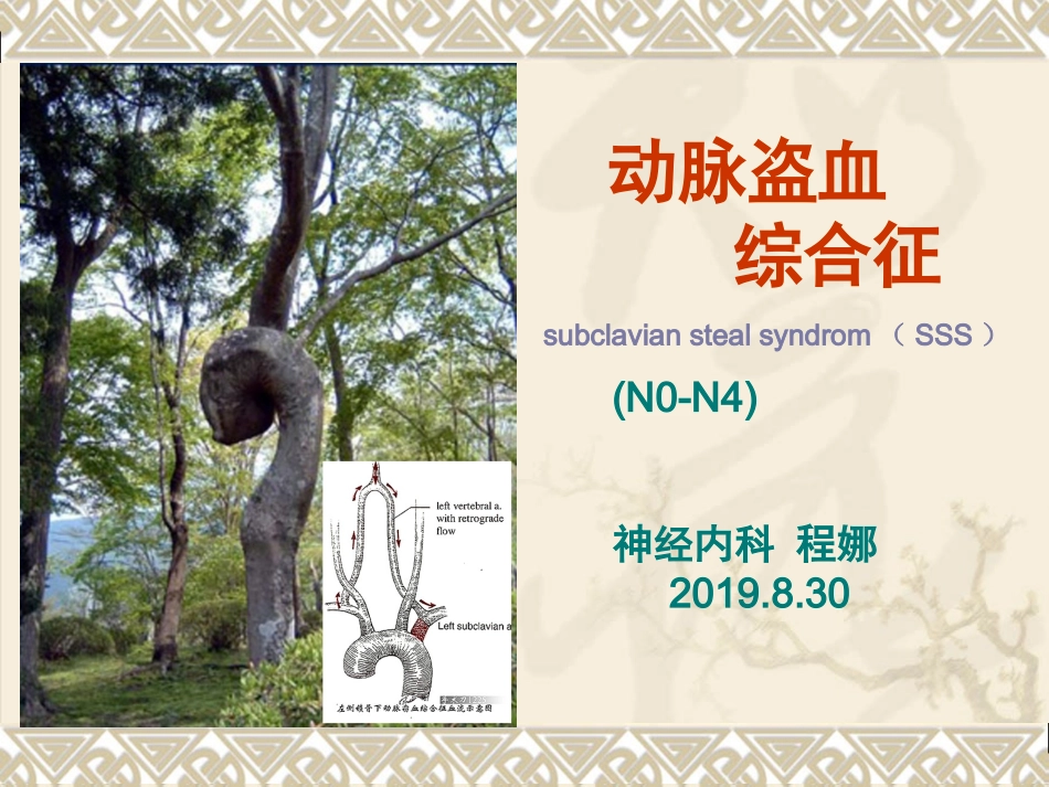 动脉盗血综合征_第1页