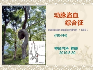 动脉盗血综合征