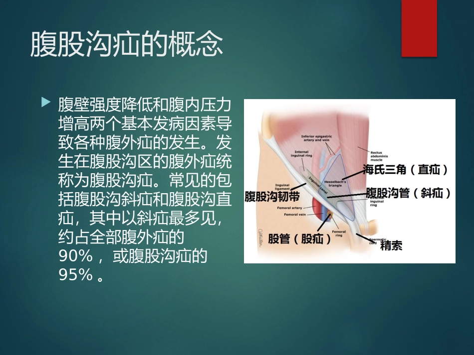 腹股沟疝的诊疗和治疗_第2页