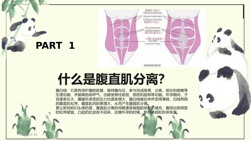 腹直肌分离修复培训课件_第3页