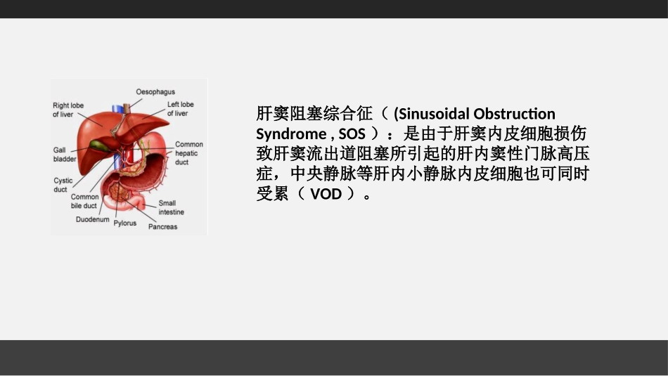 肝窦阻塞综合征本_第2页