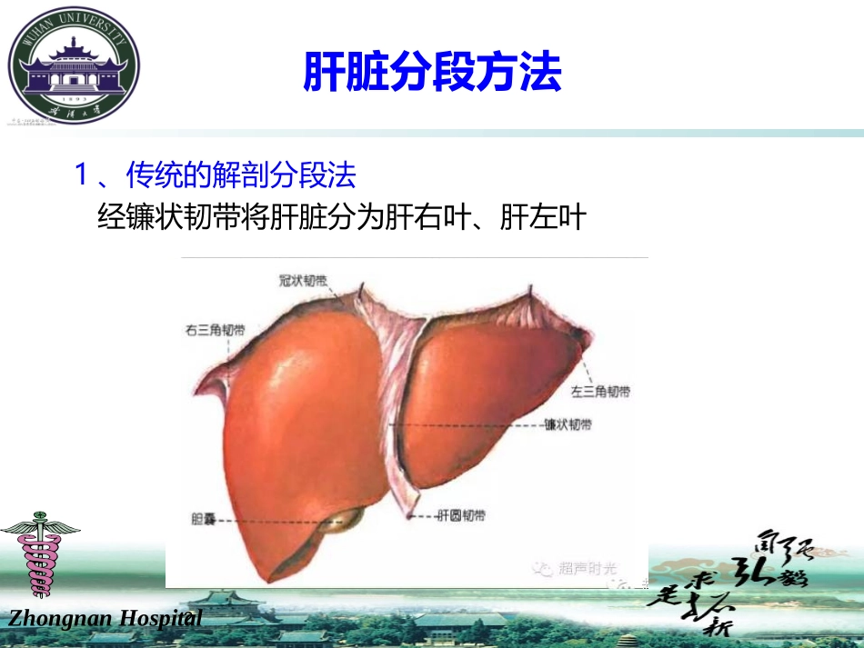 肝脏分段解剖_第2页