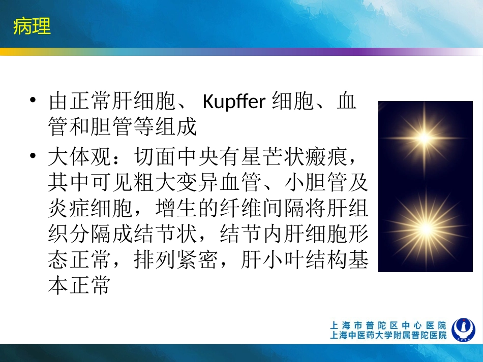 肝脏局灶性结节增生FNH_第3页