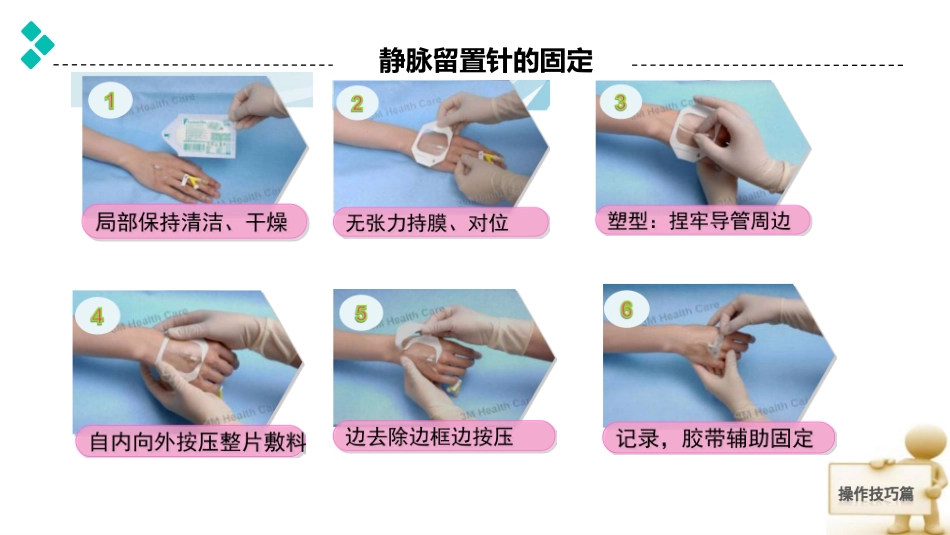 各管道的固定方法_第2页