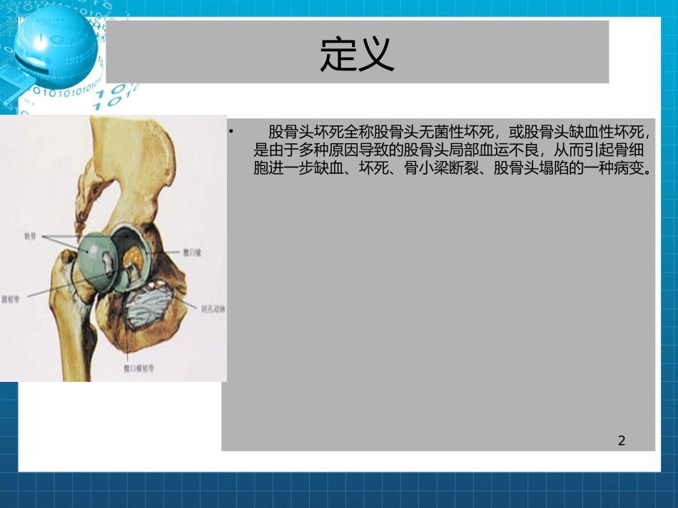 股骨头坏死病例_第2页