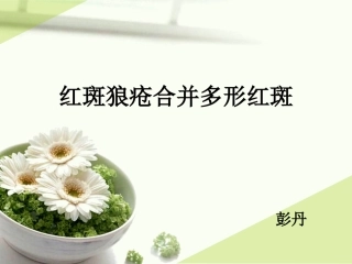 红斑狼疮和多形红斑