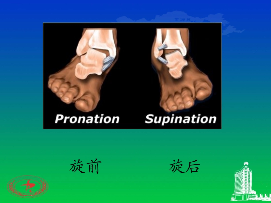 踝关节骨折的LaugeHansen分型_第2页