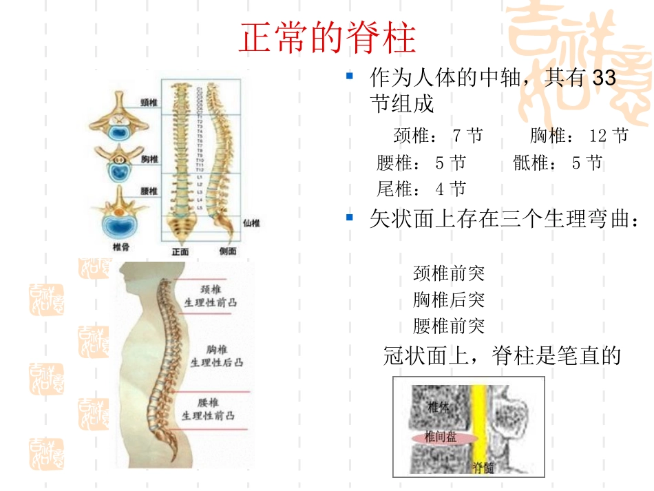 脊柱侧弯术后护理_第3页