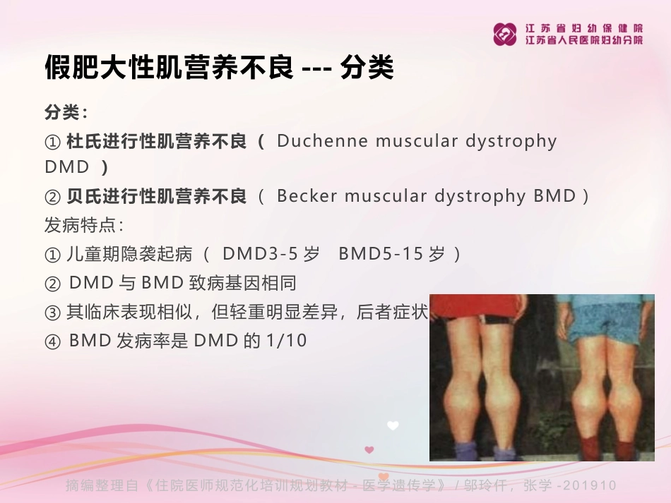 假肥大性肌营养不良_第3页