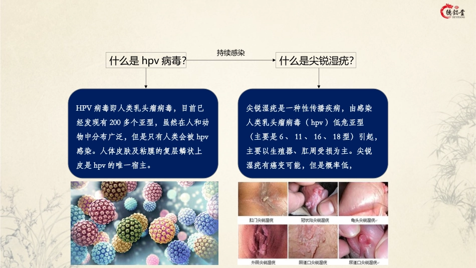 尖锐湿疣概述_第2页