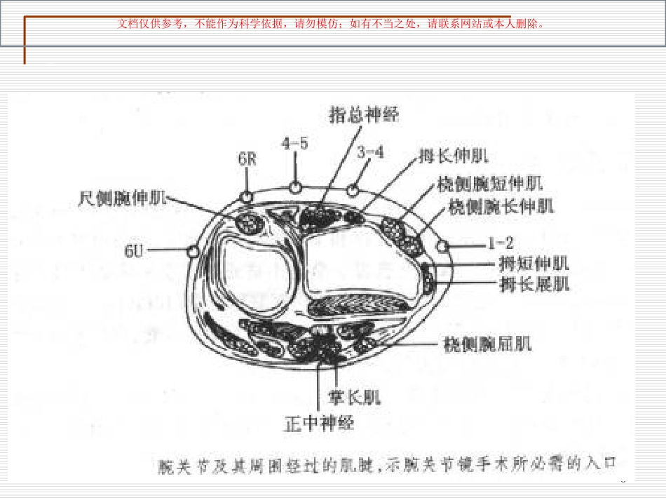 腱鞘囊肿专业知识讲座课件_第3页