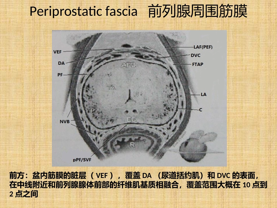 筋膜内根治性前列腺切除术_第3页
