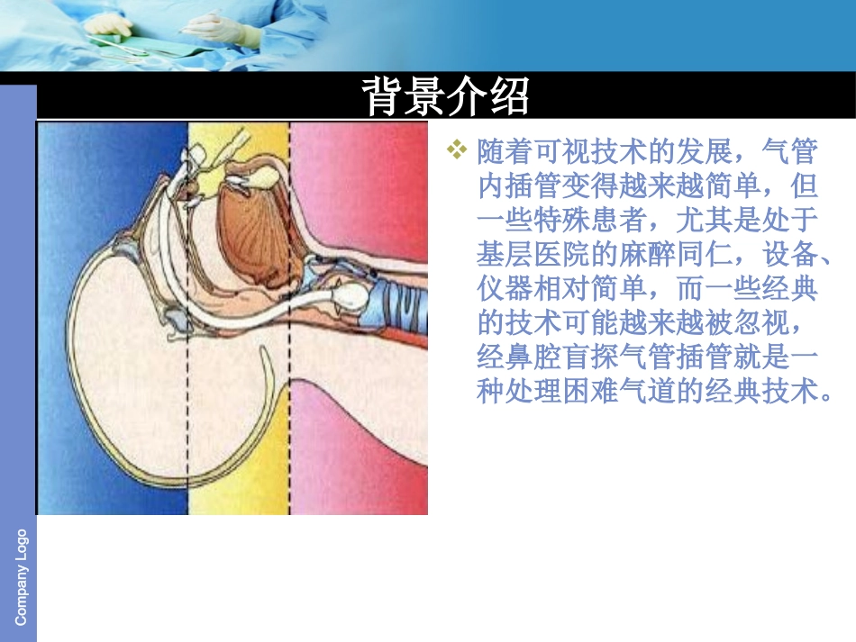 经鼻腔盲探气管插管_第3页