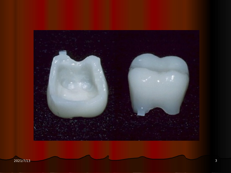 口腔科瓷全冠_第3页