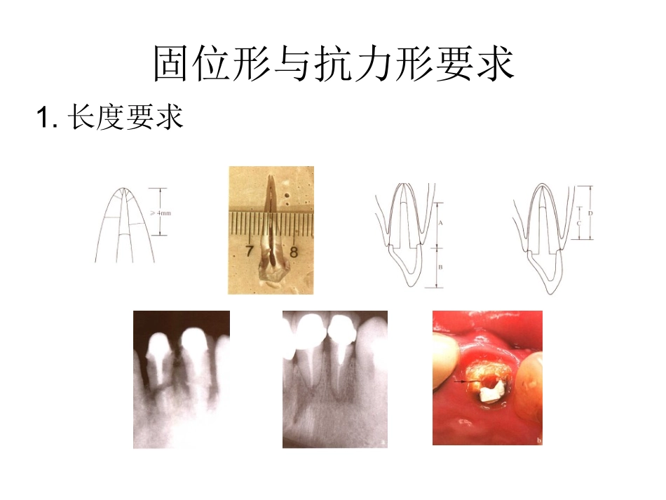 口腔修复科桩核修复技术_第3页