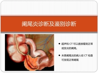 阑尾炎影像诊断及鉴别诊断