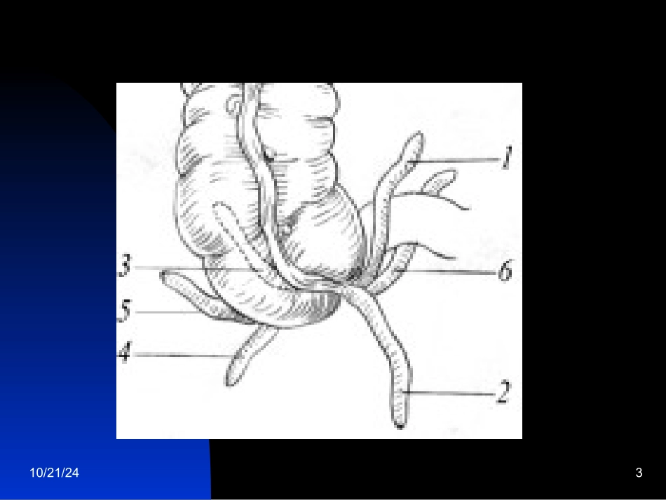 阑尾炎中文课件_第3页
