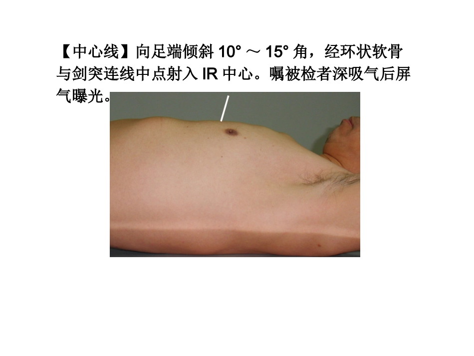 肋骨摄影体位_第3页