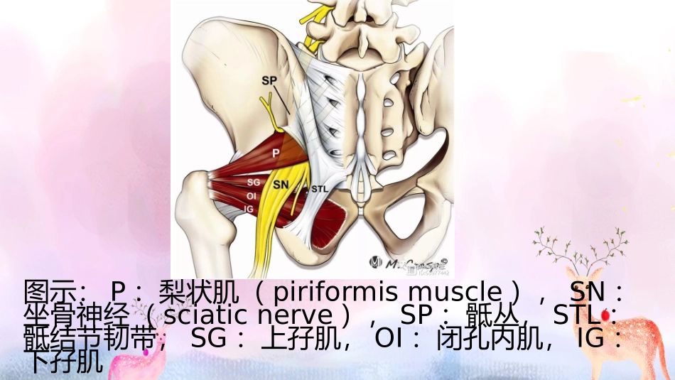 梨状肌综合症_第3页