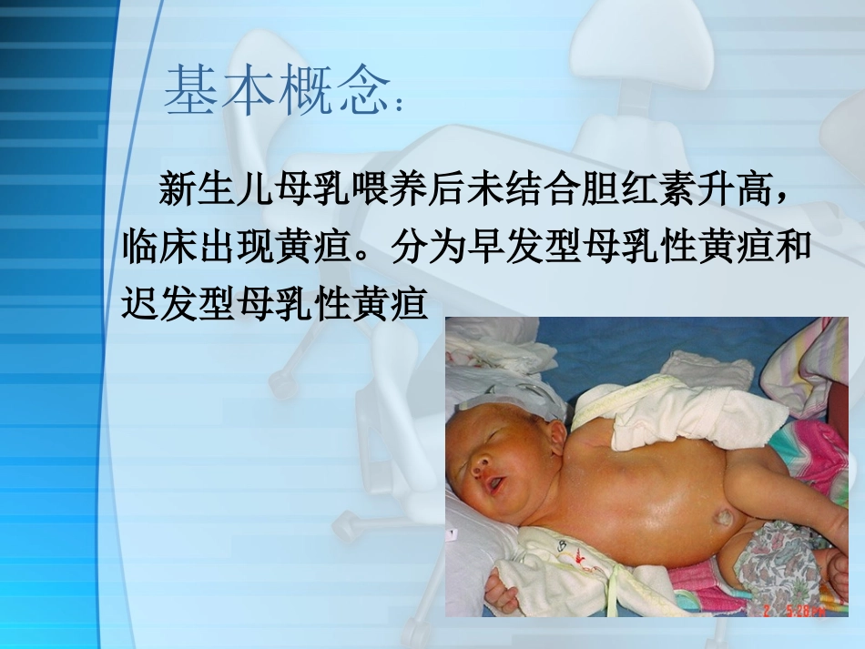 母乳性黄疸课件_第2页