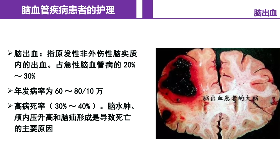 脑血管疾病的护理脑出血_第2页