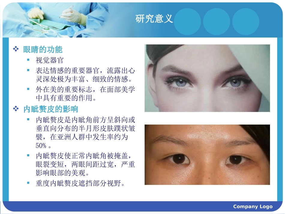 内眦赘皮的矫正开眼角_第2页