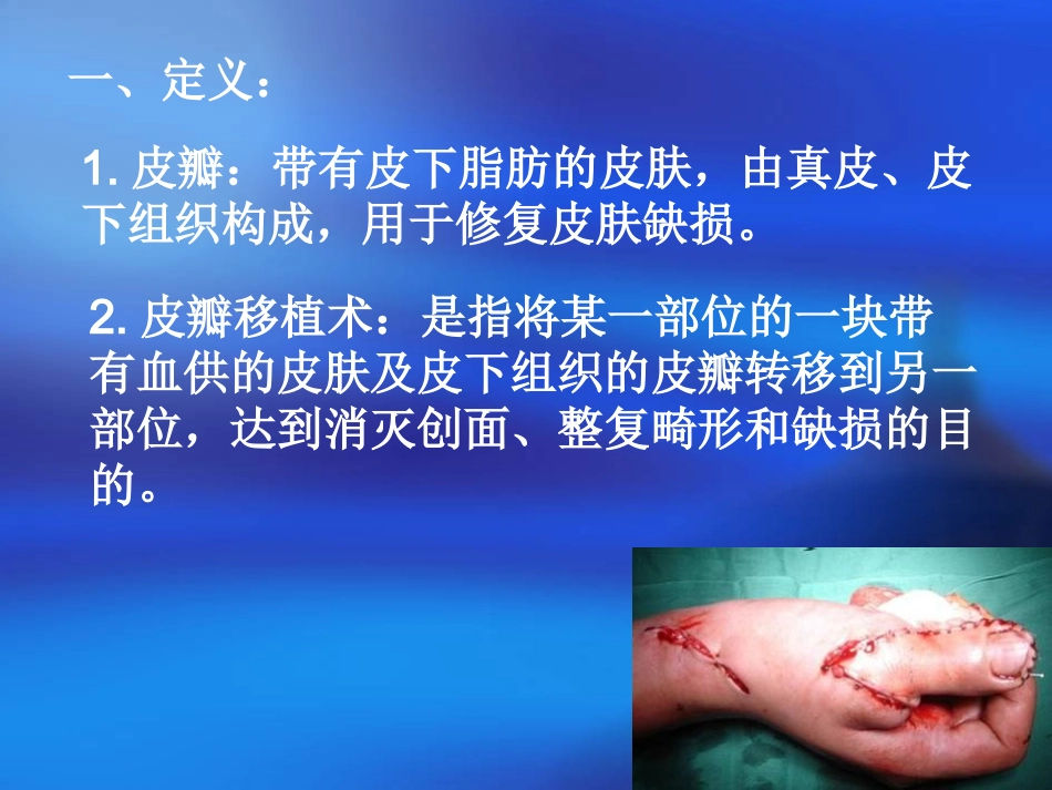 皮瓣移植术后护理_第2页