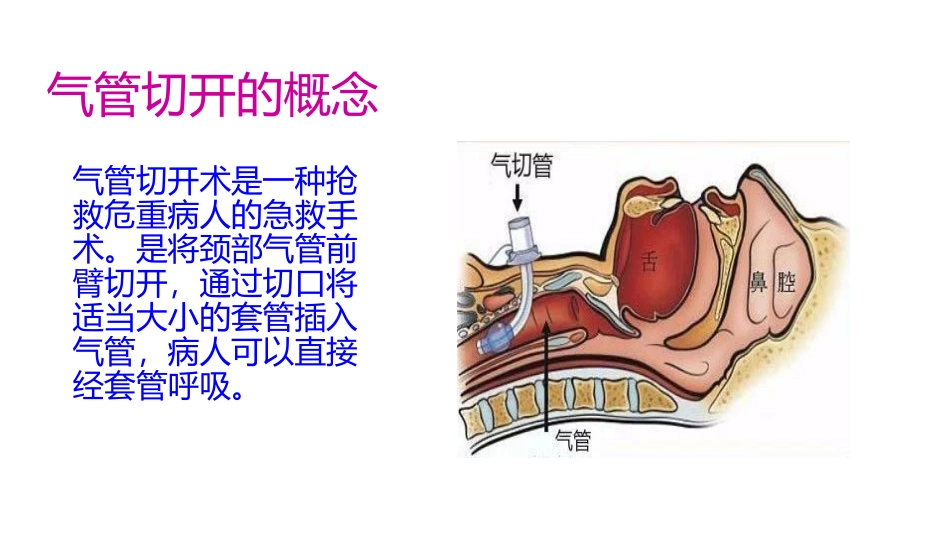 气管切开病人伤口的护理_第2页