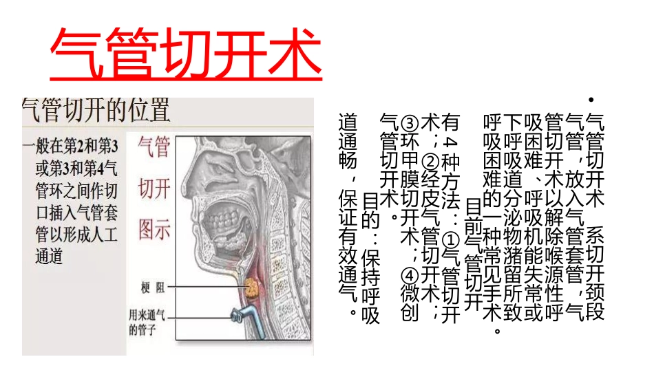 气管切开病人伤口的护理_第3页