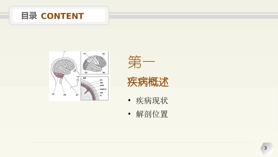 桥小脑角脑膜瘤_第3页