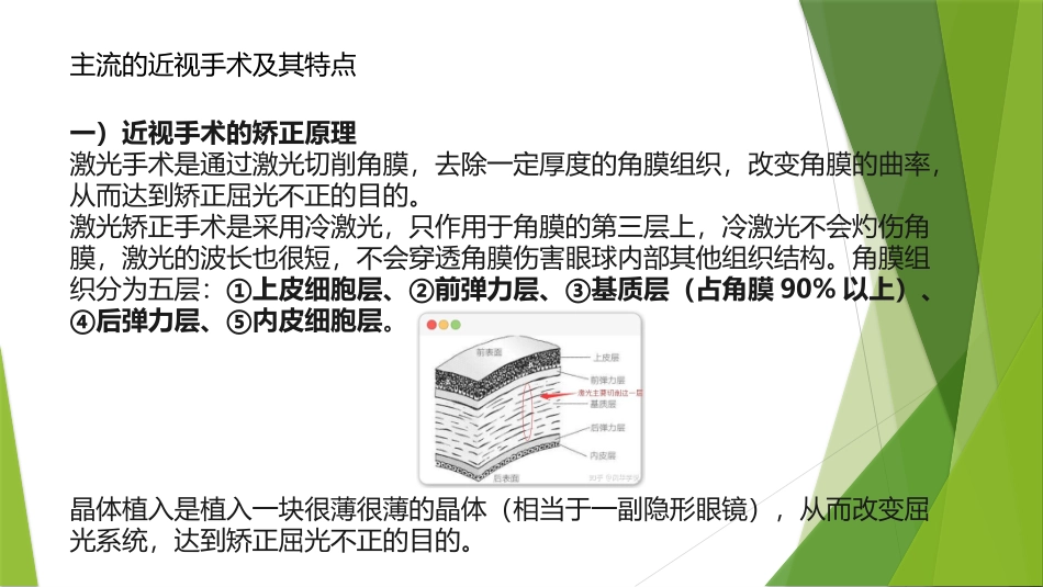 屈光手术介绍_第3页