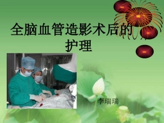 全脑血管造影术后的护理