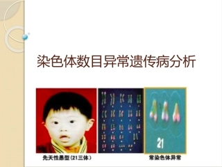 染色体数目异常遗传病分析