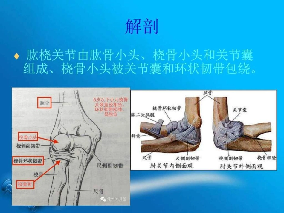 桡骨小头半脱位_第3页