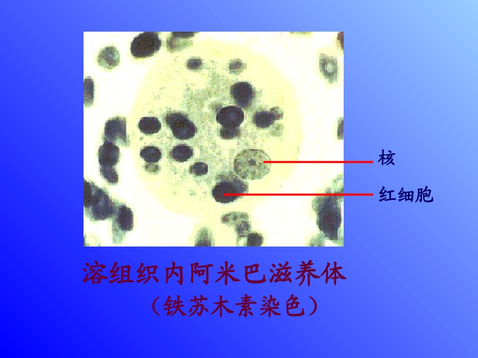 溶组织内阿米巴_第3页