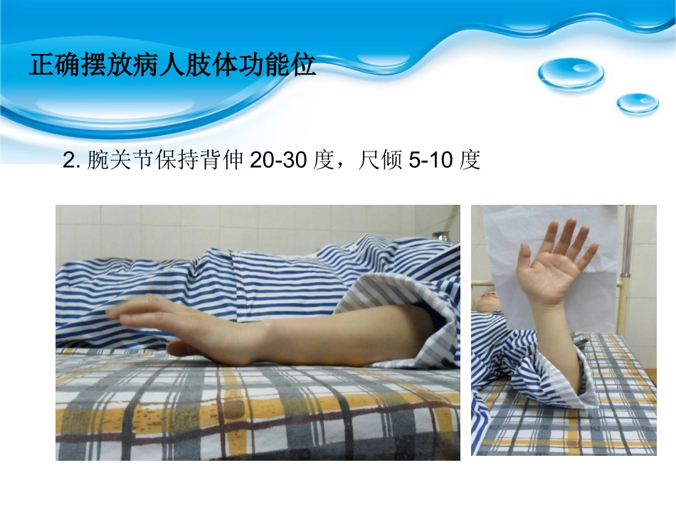 如何正确摆放四肢功能位课件_第3页