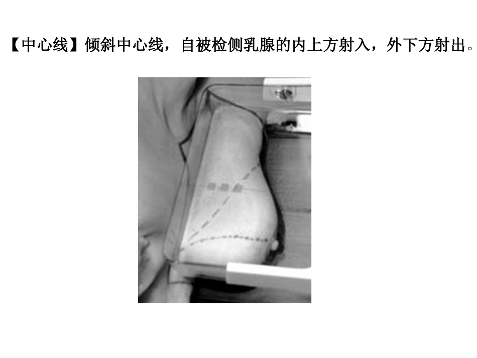 乳腺摄影体位_第3页