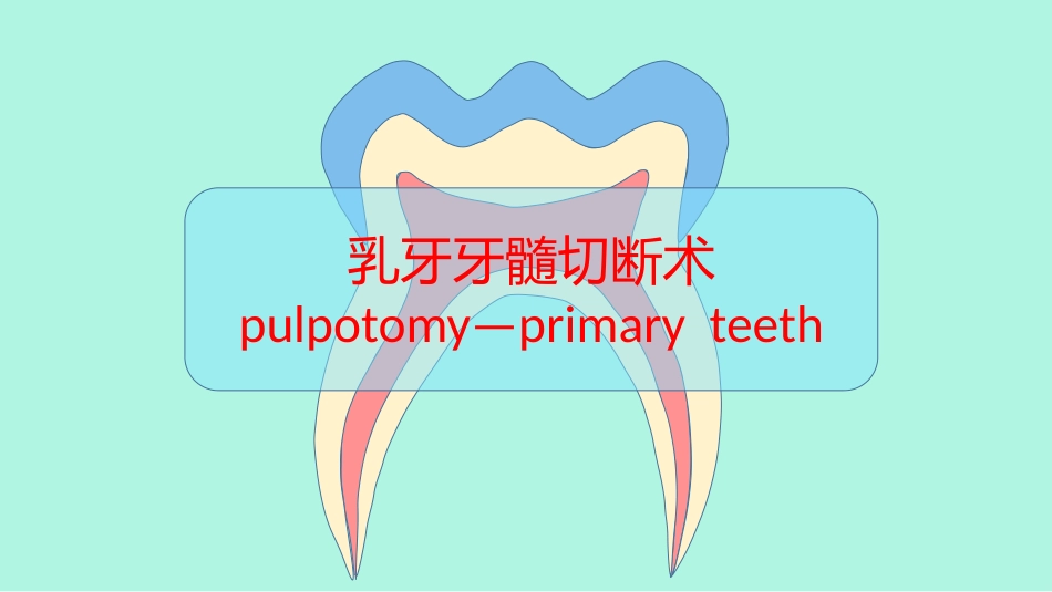 乳牙牙髓切断术_第1页
