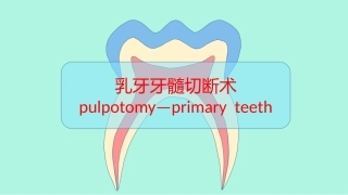 乳牙牙髓切断术