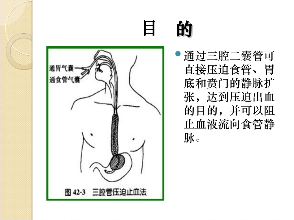三腔二囊管的安置与护理资料_第3页